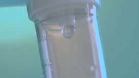 IV Drip Close Up (HD). Intravenous drip seen close up in a green hospital room. Slow drops of liquid.