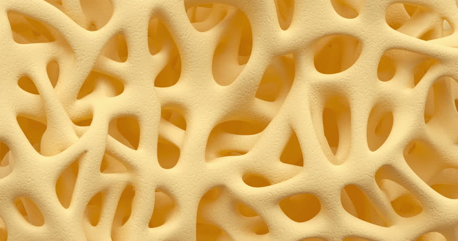 Developing of human bone osteoporosis spongy texture from normal to sick, time lapse 3d animation | Shutterstock HD Video #21302821