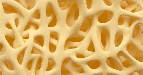 Developing of human bone osteoporosis spongy texture from normal to sick, time lapse 3d animation