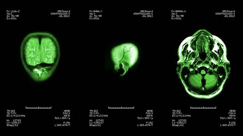 Three head views of MRI scan. Loopable. Green. See more color options in my portfolio.