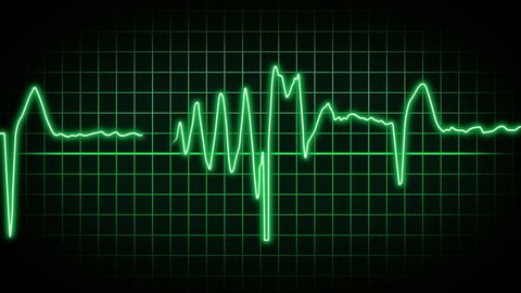 A fictional hospital computer screen monitoring a human heart.  