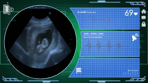 353 Sexual intercourse anatomy Stock Video Footage - 4K and HD Video