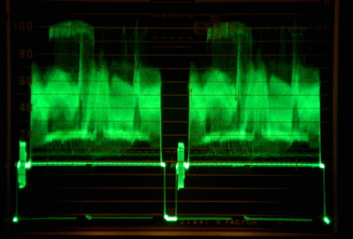 Double spikes on waveform