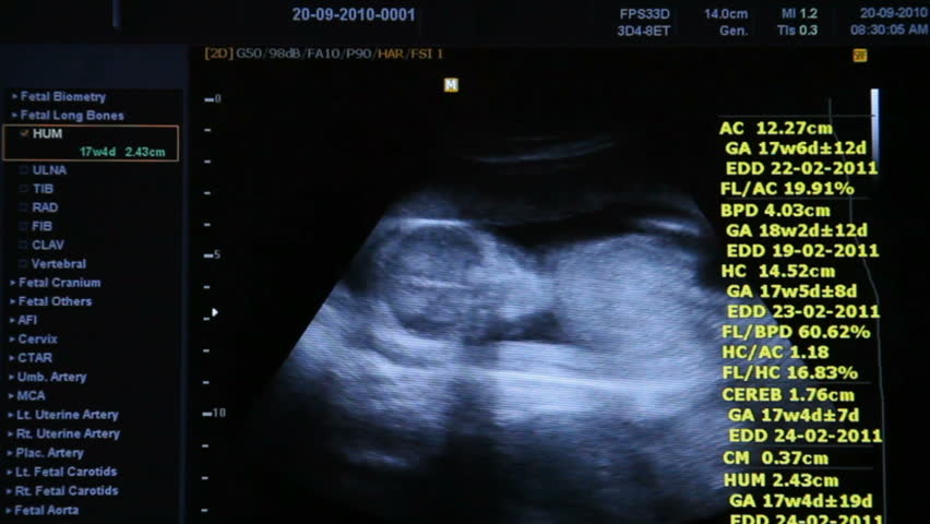 Doctor pointing to ultrasound of fetus