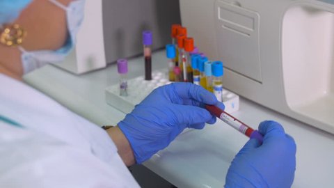 Lab technician operating test tubes, testing blood samples in laboratory using modern medical equipment.