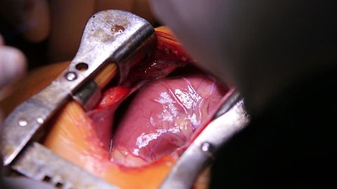 Human heart beating close-up during the surgery (1080p, 25fps)