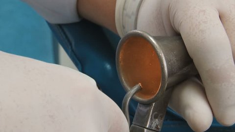 Proctologist shows an example Ligation of hemorrhoids latex rings, close-up