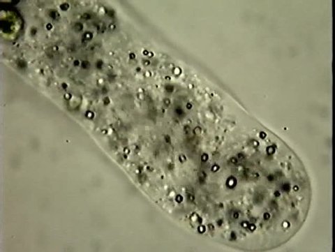 Microscopic: A long shot of an amoeba and then a very close shot showing pseudopod detail.  The amoeba is commonly studied by science students elementary through college