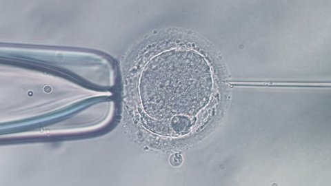 Viewing through microscope on icsi in vitro fertilization procedure, needle puncture of human egg and sperm injection.