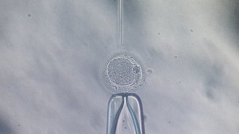 Microscope view of in vitro fertilization IntraCytoplasmic Sperm Injection, ivf icsi