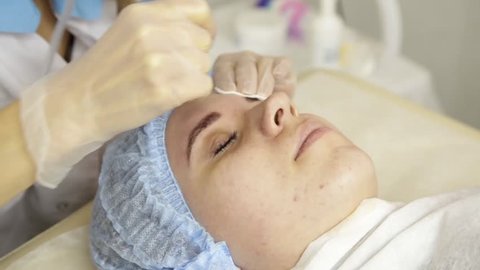 Diamond microdermabrasion, peeling treatment at cosmetic beauty spa clinic. woman getting a vacuum microdermabrasion procedure