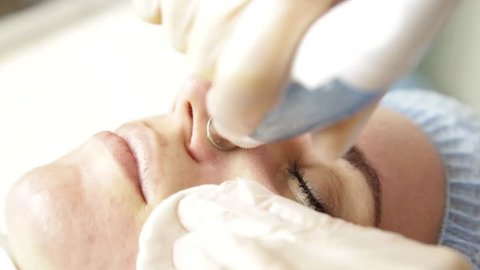 Diamond microdermabrasion, peeling treatment at cosmetic beauty spa clinic. woman getting a vacuum microdermabrasion procedure