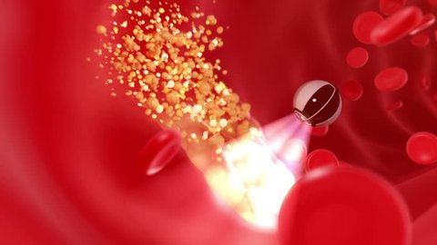 Nanobot finds and removes forming cholesterol plaque, abstract conceptual 3d animation. full HD 1080
