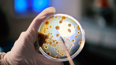 Close-up of human hands in medical gloves scraping colonies of bacteria. Petri dish with virus samples. Chemistry, medicine, laboratory.