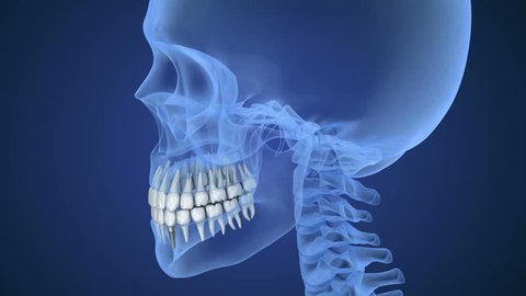 X-ray view of denture with implant. Xray view. Medically accurate 3D illustration 