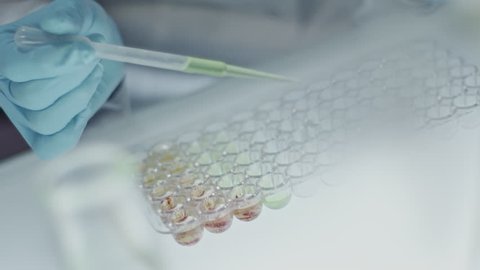 Close up of hands of scientist in gloves holding pipette and pouring solutions into tray