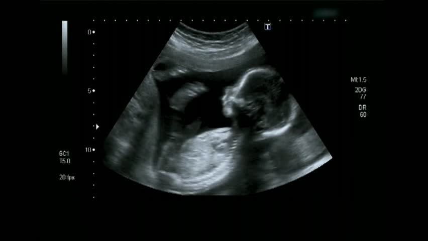 Фото малыша в утробе в 20 недель
