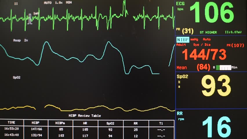 Ekg Monitor in Icu Unit Stock Footage Video (100 Royalty