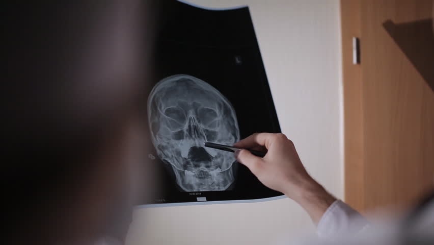 Healthcare, medical: Group of multi-ethnic doctors discuss and looking x-ray in a clinic or hospital