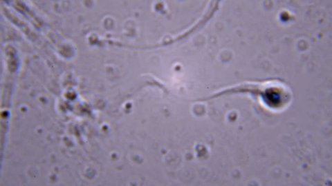 Seeing sperm activity using a microscope at extreme magnification about 1000x