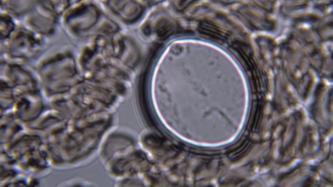 Footage on the theme blood, diseases, interstitial fluid, bacterial background, research using a microscope at extreme magnification of about 1000x