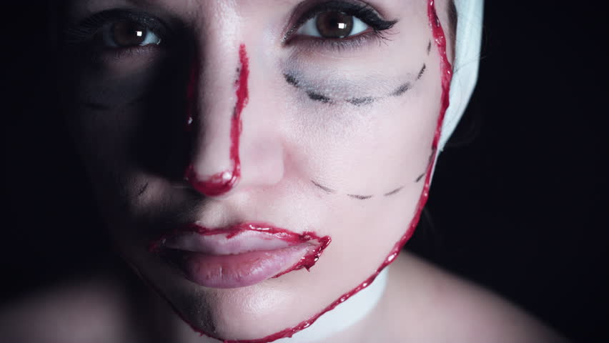 4K Plastic Surgery Victim Woman Injecting her Lips, a Healthcare Video by MarioProduction