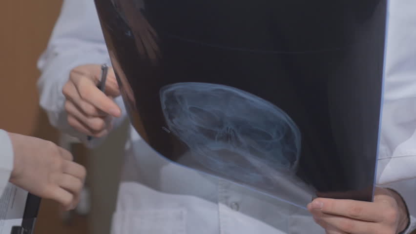 Two doctors consider a patient of x-ray picture