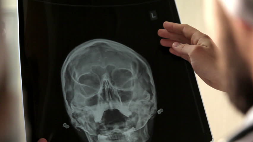 Doctor analyzing human skull x-ray screening image in hospital