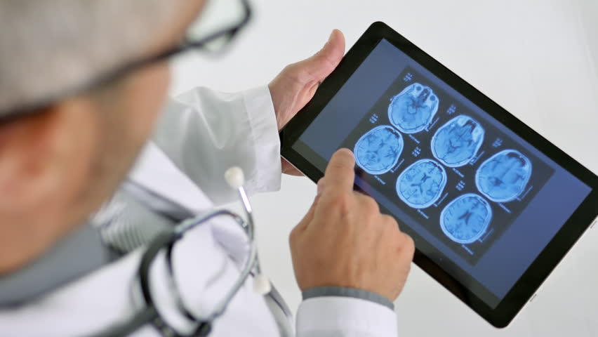 doctor looking at brain x rays scan on tablet top view from above Royalty-Free Stock Footage #24273206