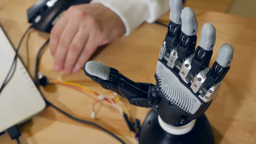 Expanded prosthetics and organ engineering. Бионический протез руки bebionic. Бионический протез с часами. Бионические протезы моторика трёхпалые. Бионическая рука своими руками.