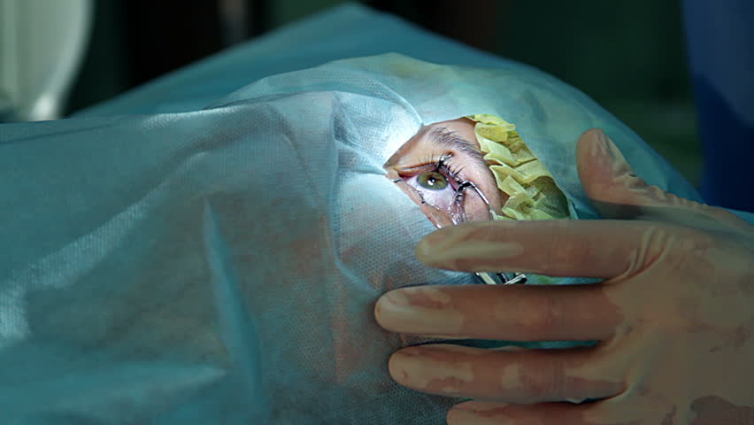 Anesthesia before surgery laser vision correction, ophthalmology operation, Surgeon's hands in gloves performing laser eye vision correction correction, surgery eye, Cataract surgery | Shutterstock HD Video #24542138