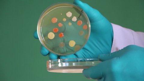 Glowed hands are opening  glass petri dish loaded with agar nutrient  media. Bacterial colonies grow in petri dish.   Green chalkboard background. Nutrient peptone agar is used in petri dish.