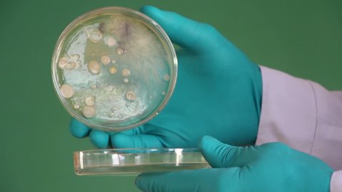 Glowed hands are opening  glass petri dish loaded with agar nutrient  media. Different bacterial colonies grow on media.  Lockdown.  Nutrient meat-peptone agar is used. Green chalkboard background.