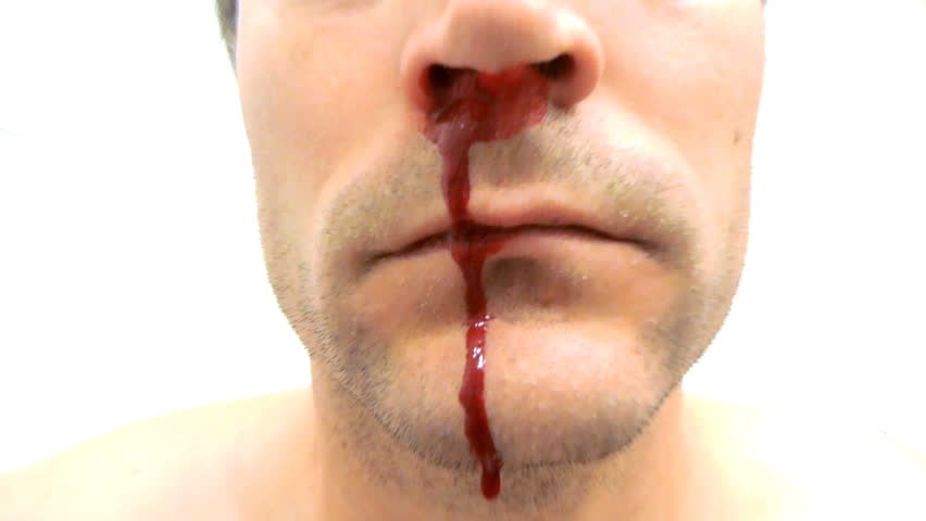 Man's nose bleeding with zoom in effect.