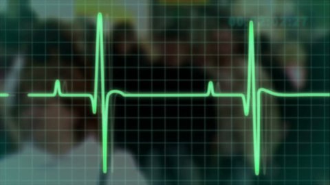 electrocardiogram pulse trace