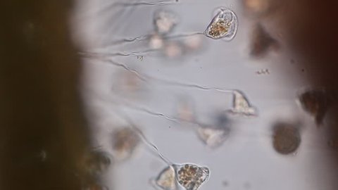 Vorticella (organism) in waste water under the microscope.