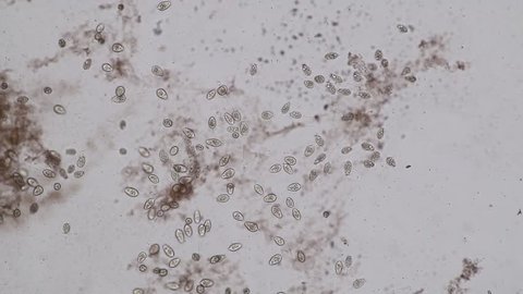 Vorticella (organism) in waste water under the microscope.	