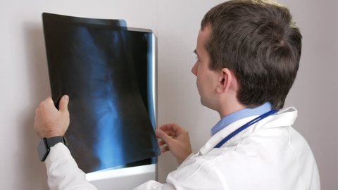 A young doctor examines the results of a patient's X-ray on the wall. Analyzes of the thorax and ribs.