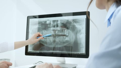 Doctor shows your patient the situation of her teeth. Doctor giving consultation to patient. Dentist shows x-ray her teeth.
