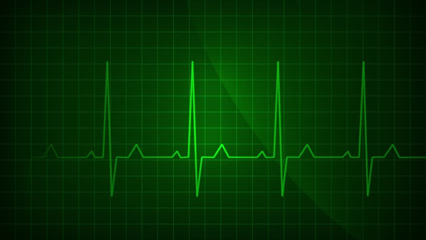 EKG ECG Monitor Electrocardiogram Display Looping 