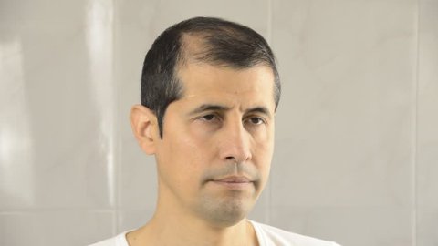 man controls hair loss and unhappy gazing at you in the mirror