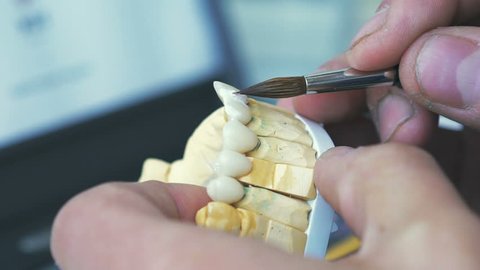 Dental technician applying ceramics glaze to a cast made with CNC dental machine