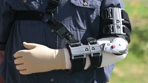 Man in adjustable arm brace after surgery