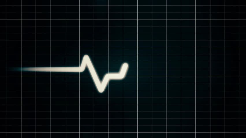 heart monitor screen Royalty-Free Stock Footage #26590280