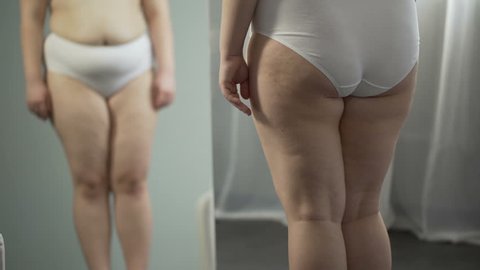 Woman looking in mirror, cellulite and stretch marks on hips, touching big belly, appearance insecurities. Sedentary lifestyle, unhealthy nutrition, hormonal disease, obesity problem, lack of sport
