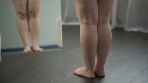 Legs of excess weight woman with flat feet and cellulite, obesity problems