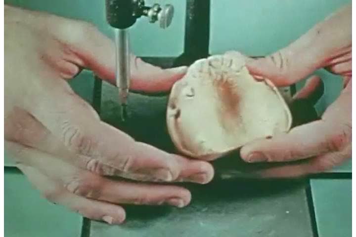1940s: A dentist uses an instrument to cut and shape dentures, in 1944.