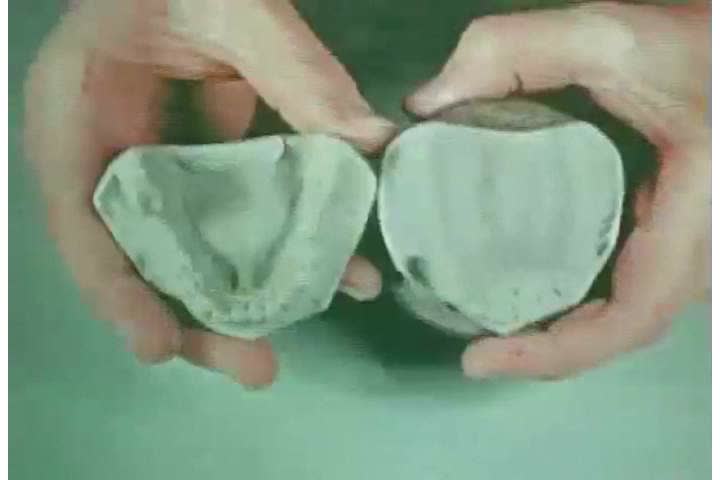 1940s: A dentist uses equipment to work on dentures, in 1944.