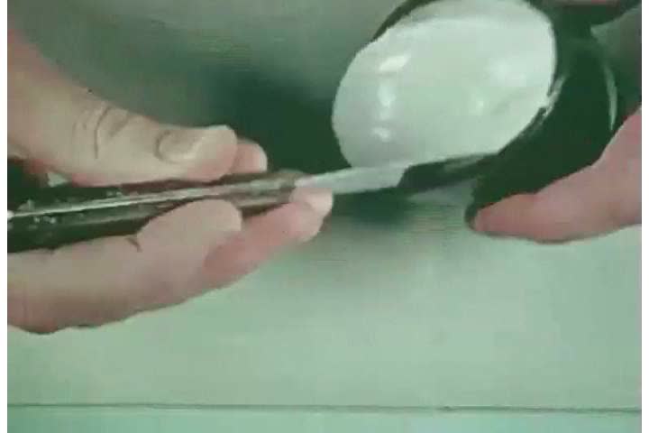 1940s: A dentist uses impression material and metal stock trays to make a mold of teeth and gums, in 1944._