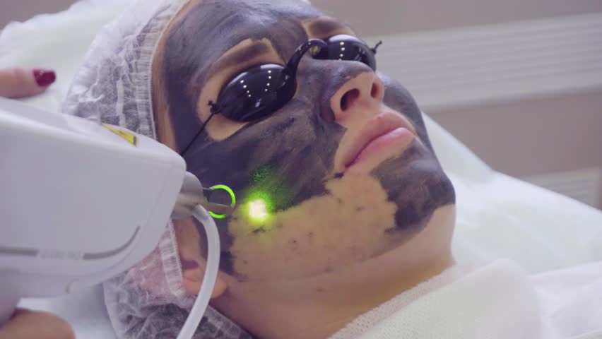 Carbon face peeling procedure. Laser pulses clean skin of the face. Hardware cosmetology treatment. Process of photothermolysis, warming the skin, laser carbon peeling. Facial skin rejuvenation. Royalty-Free Stock Footage #27058084
